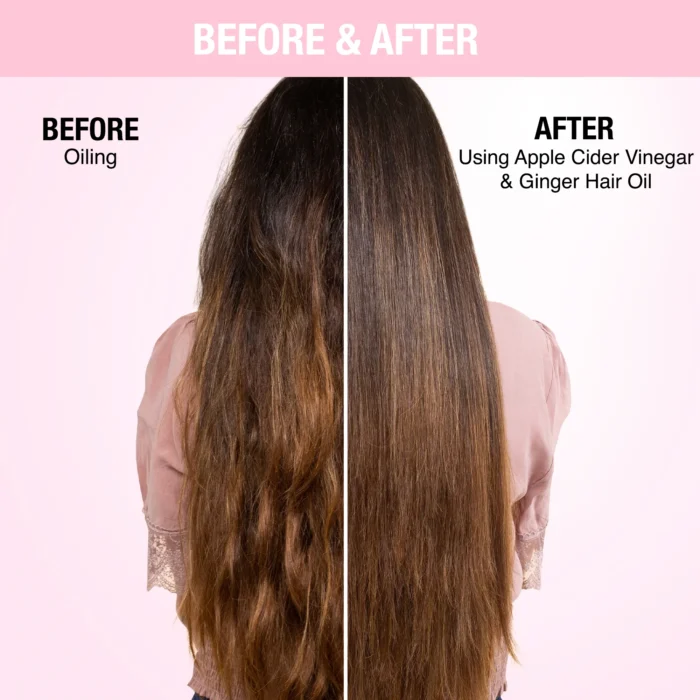 Nykaa Hair Oil - Apple Cider Vinegar and Ginger by Nykaa Naturals for Women - 6.76 oz Oil - Image 3